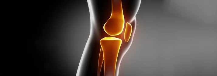 Chiropractic Laguna Hills CA Knee Pain