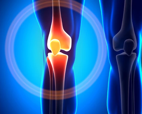 Chiropractic Laguna Hills CA Shockwave For Knee