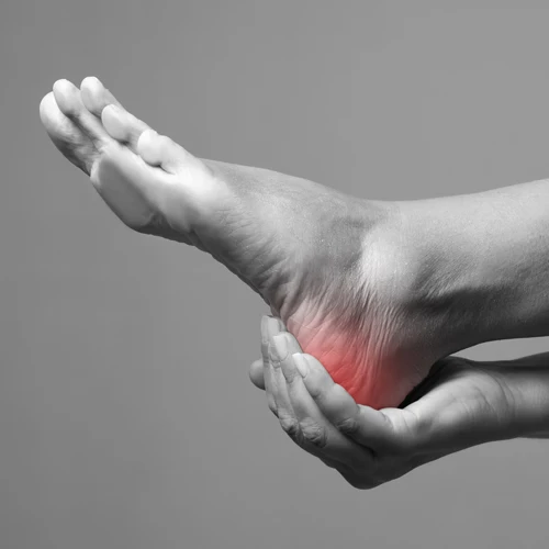 Chiropractic Laguna Hills CA Plantar Fasciitis Heel